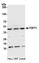 FDFT1 Antibody in Western Blot (WB)