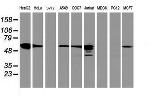 FDFT1 Antibody in Western Blot (WB)