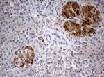 FEN1 Antibody in Immunohistochemistry (Paraffin) (IHC (P))