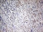 FEN1 Antibody in Immunohistochemistry (Paraffin) (IHC (P))