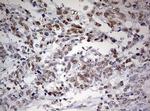 FEN1 Antibody in Immunohistochemistry (Paraffin) (IHC (P))