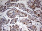 FEN1 Antibody in Immunohistochemistry (Paraffin) (IHC (P))