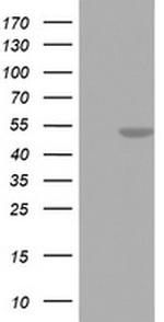 FEN1 Antibody in Western Blot (WB)