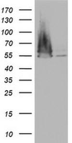 FEN1 Antibody in Western Blot (WB)