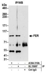 FER Antibody in Western Blot (WB)