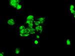 FERMT2 Antibody in Immunocytochemistry (ICC/IF)