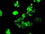 FERMT2 Antibody in Immunocytochemistry (ICC/IF)