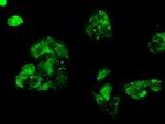 FERMT2 Antibody in Immunocytochemistry (ICC/IF)