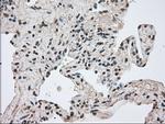 FERMT2 Antibody in Immunohistochemistry (Paraffin) (IHC (P))