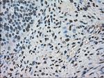 FERMT2 Antibody in Immunohistochemistry (Paraffin) (IHC (P))