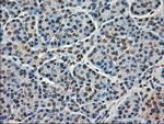 FERMT2 Antibody in Immunohistochemistry (Paraffin) (IHC (P))