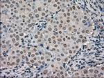 FERMT2 Antibody in Immunohistochemistry (Paraffin) (IHC (P))