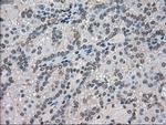 FERMT2 Antibody in Immunohistochemistry (Paraffin) (IHC (P))