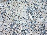 FERMT2 Antibody in Immunohistochemistry (Paraffin) (IHC (P))