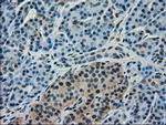 FERMT2 Antibody in Immunohistochemistry (Paraffin) (IHC (P))