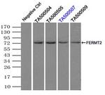 FERMT2 Antibody in Immunoprecipitation (IP)