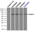 FERMT2 Antibody in Immunoprecipitation (IP)