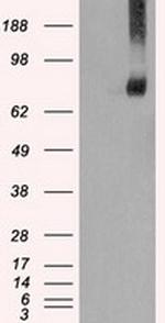 FERMT2 Antibody in Western Blot (WB)