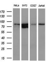 FERMT2 Antibody in Western Blot (WB)