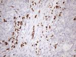 FERMT3 Antibody in Immunohistochemistry (Paraffin) (IHC (P))