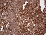 FERMT3 Antibody in Immunohistochemistry (Paraffin) (IHC (P))