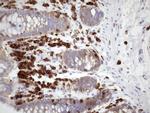 FERMT3 Antibody in Immunohistochemistry (Paraffin) (IHC (P))