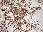 FERMT3 Antibody in Immunohistochemistry (Paraffin) (IHC (P))