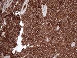 FERMT3 Antibody in Immunohistochemistry (Paraffin) (IHC (P))