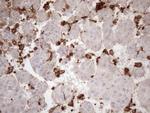 FERMT3 Antibody in Immunohistochemistry (Paraffin) (IHC (P))