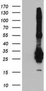 FGF21 Antibody in Western Blot (WB)