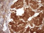 FGFBP1 Antibody in Immunohistochemistry (Paraffin) (IHC (P))