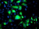 FGFR2 Antibody in Immunocytochemistry (ICC/IF)