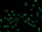 FGFR2 Antibody in Immunocytochemistry (ICC/IF)