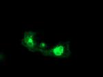 FGFR2 Antibody in Immunocytochemistry (ICC/IF)