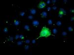 FGFR2 Antibody in Immunocytochemistry (ICC/IF)