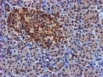 FGFR2 Antibody in Immunohistochemistry (Paraffin) (IHC (P))