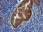 FGFR2 Antibody in Immunohistochemistry (Paraffin) (IHC (P))