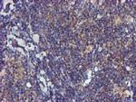 FGFR2 Antibody in Immunohistochemistry (Paraffin) (IHC (P))