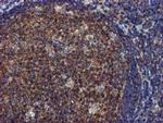 FGFR2 Antibody in Immunohistochemistry (Paraffin) (IHC (P))