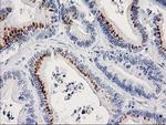 FGFR2 Antibody in Immunohistochemistry (Paraffin) (IHC (P))