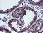 FGFR2 Antibody in Immunohistochemistry (Paraffin) (IHC (P))