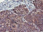 FGFR2 Antibody in Immunohistochemistry (Paraffin) (IHC (P))