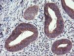 FGFR2 Antibody in Immunohistochemistry (Paraffin) (IHC (P))