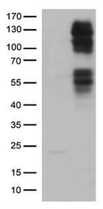 FGFR2 Antibody in Western Blot (WB)