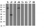 FGFR2 Antibody in Western Blot (WB)