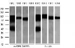 FGFR2 Antibody in Western Blot (WB)