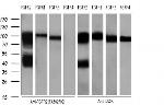 FGFR2 Antibody in Western Blot (WB)