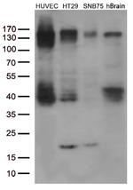 FGFR2 Antibody in Western Blot (WB)