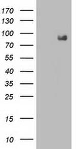 FGFR2 Antibody in Western Blot (WB)