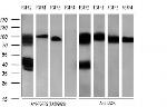 FGFR2 Antibody in Western Blot (WB)